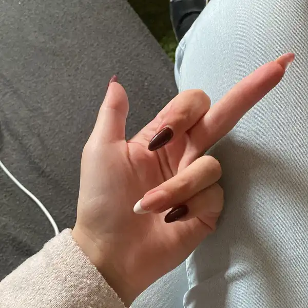 Nedovolený výstřik