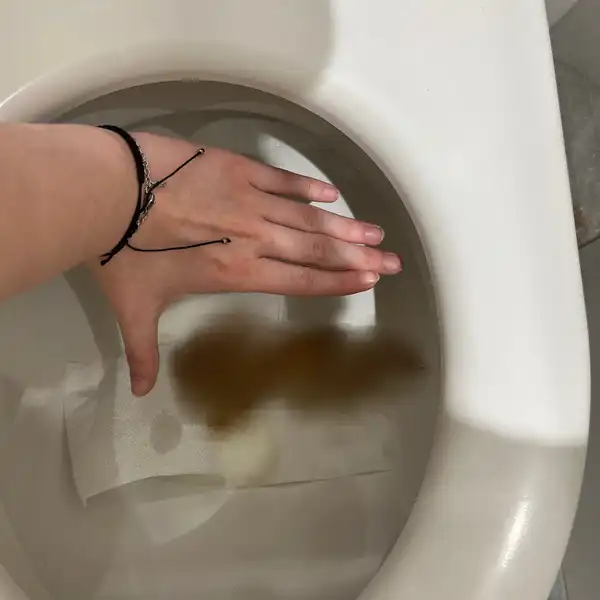 4 dny kakání