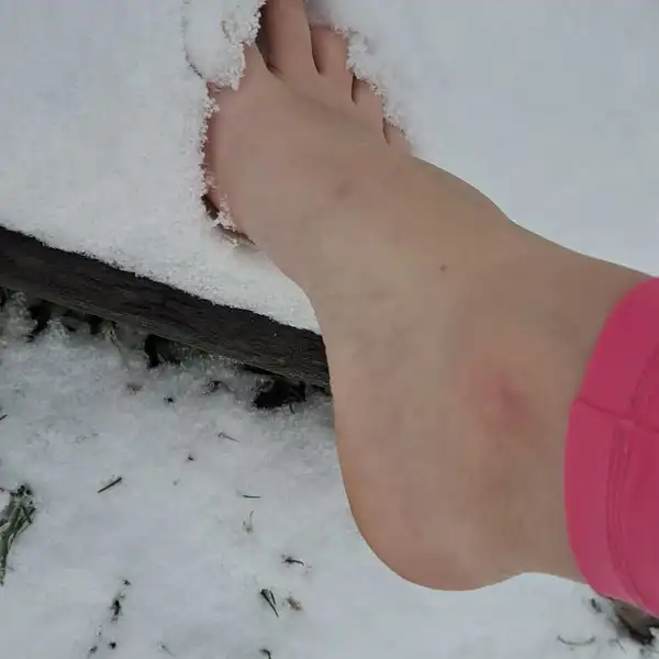 10 fotek zmrzlých nožiček