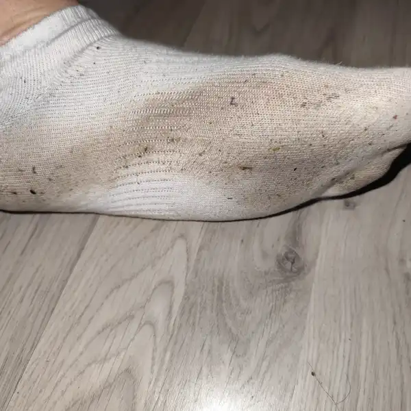 Super smradlavé z pracáků
