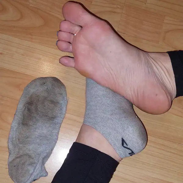 Dvoudenní smradlavky